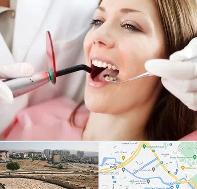 متخصص درمان ریشه دندان در کوی وحدت شیراز