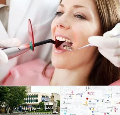 متخصص درمان ریشه دندان در طالقانی