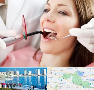 متخصص درمان ریشه دندان در چیتگر 