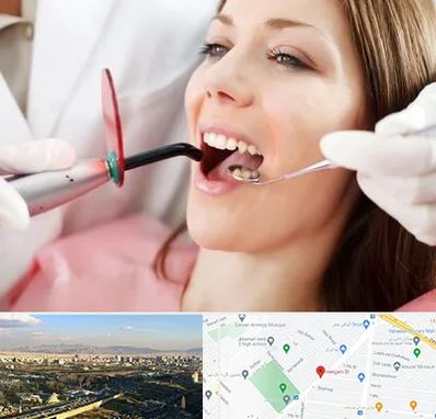 متخصص درمان ریشه دندان در هنگام