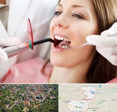 متخصص درمان ریشه دندان در دماوند