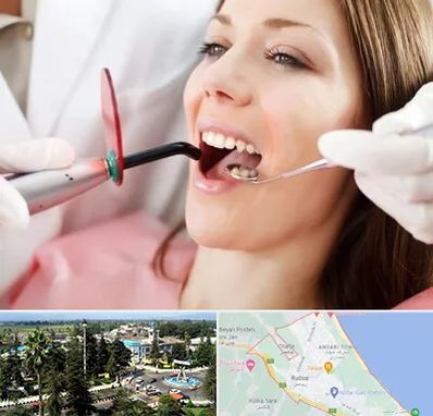 متخصص درمان ریشه دندان در رودسر