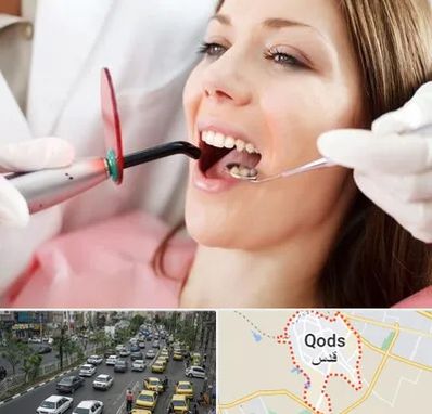متخصص درمان ریشه دندان در شهر قدس