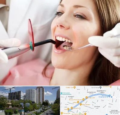 متخصص درمان ریشه دندان در اندرزگو