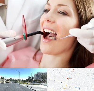 متخصص درمان ریشه دندان در بلوار کلاهدوز مشهد