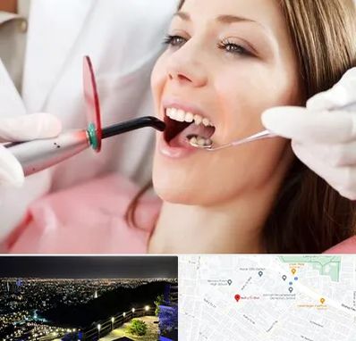 متخصص درمان ریشه دندان در هفت تیر مشهد