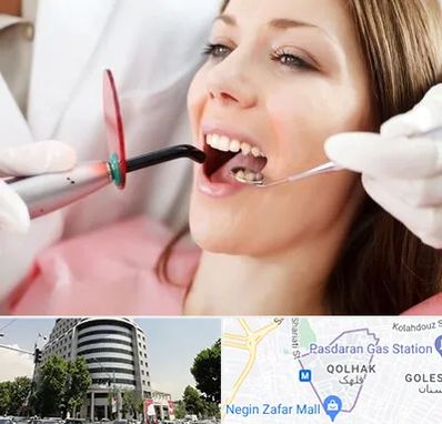 متخصص درمان ریشه دندان در قلهک 