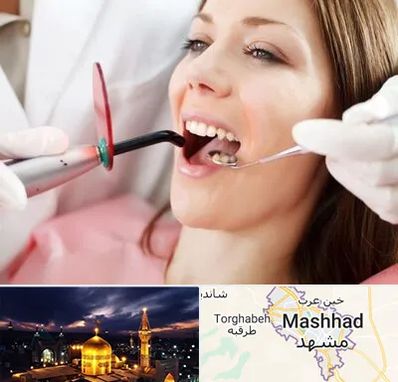 متخصص درمان ریشه دندان در مشهد