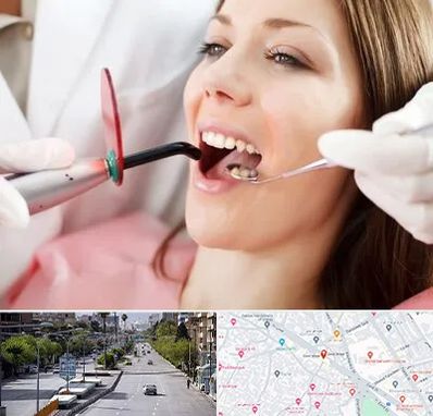 متخصص درمان ریشه دندان در خیابان زند شیراز