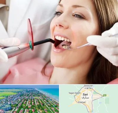متخصص درمان ریشه دندان در ساری