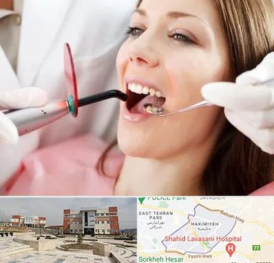 متخصص درمان ریشه دندان در حکیمیه 