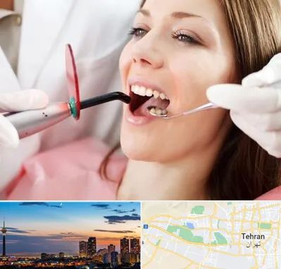 متخصص درمان ریشه دندان در غرب تهران 