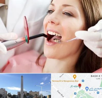 متخصص درمان ریشه دندان در فلکه گاز شیراز
