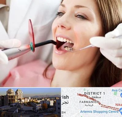 متخصص درمان ریشه دندان در فرمانیه 