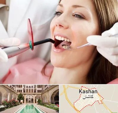 متخصص درمان ریشه دندان در کاشان