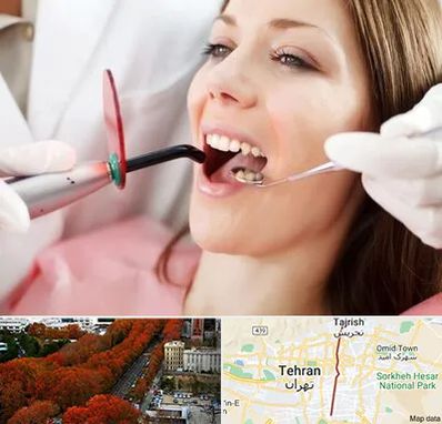 متخصص درمان ریشه دندان در ولیعصر 