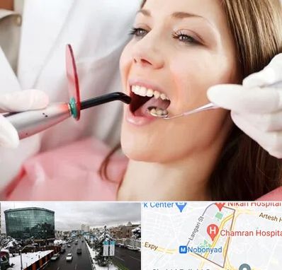 متخصص درمان ریشه دندان در اقدسیه 