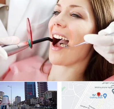 متخصص درمان ریشه دندان در چهارراه طالقانی کرج
