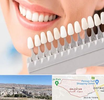 متخصص لمینت دندان در شهرک گلستان شیراز