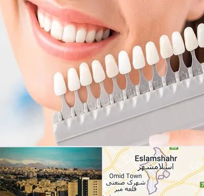 متخصص لمینت دندان در اسلامشهر