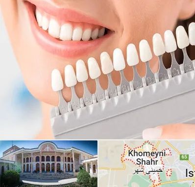 متخصص لمینت دندان در خمینی شهر