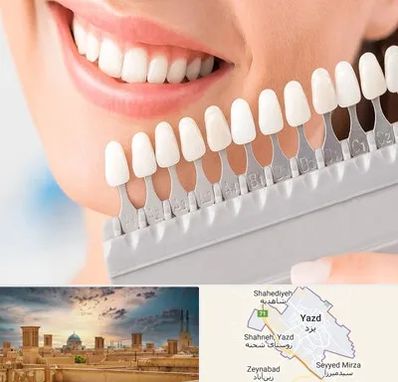 متخصص لمینت دندان در یزد