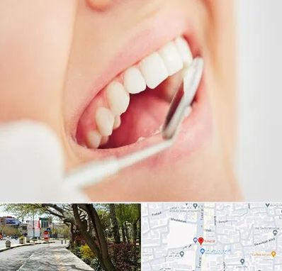 اصلاح طرح لبخند در خیابان توحید اصفهان