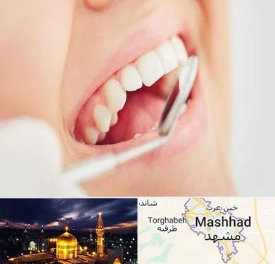 اصلاح طرح لبخند در مشهد