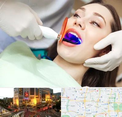 دندانپزشکی بدون درد در جنت آباد تهران 