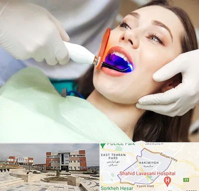 دندانپزشکی بدون درد در حکیمیه 