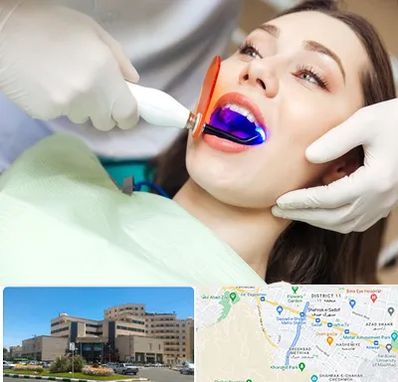 دندانپزشکی بدون درد در صیاد شیرازی مشهد
