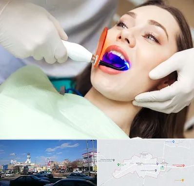 دندانپزشکی بدون درد در ماهدشت کرج