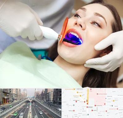 دندانپزشکی بدون درد در توحید