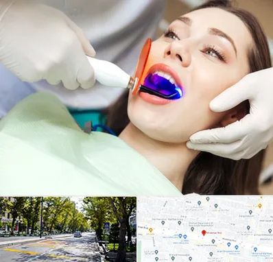 دندانپزشکی بدون درد در میرداماد