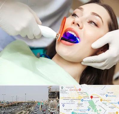 دندانپزشکی بدون درد در بلوار توس مشهد