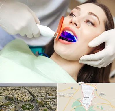 دندانپزشکی بدون درد در قزوین