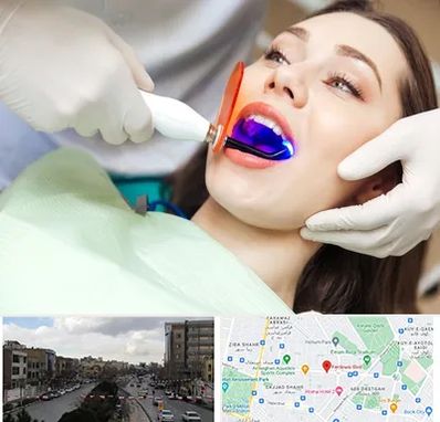 دندانپزشکی بدون درد در بلوار فردوسی مشهد