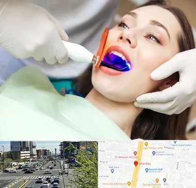 دندانپزشکی بدون درد در ستاری