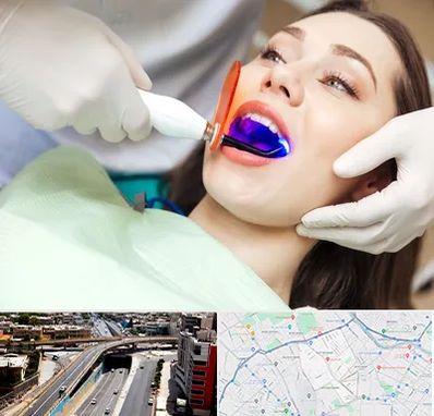 دندانپزشکی بدون درد در ستارخان شیراز