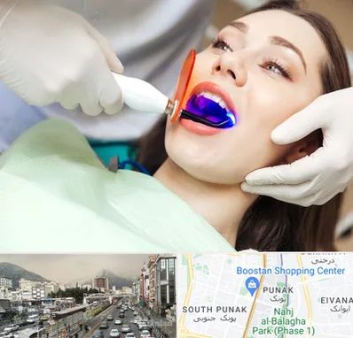 دندانپزشکی بدون درد در پونک 