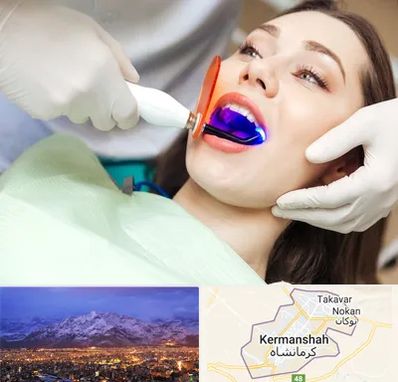 دندانپزشکی بدون درد در کرمانشاه