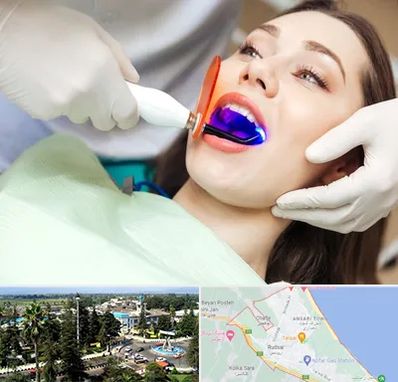 دندانپزشکی بدون درد در رودسر
