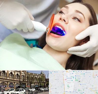 دندانپزشکی بدون درد در منطقه 11 تهران