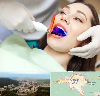 دندانپزشکی بدون درد در گرگان