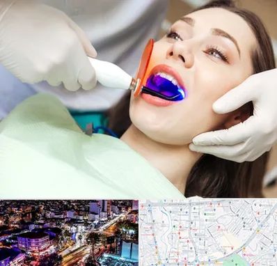 دندانپزشکی بدون درد در منظریه رشت