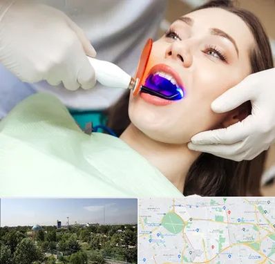 دندانپزشکی بدون درد در منطقه 16 تهران