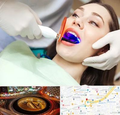 دندانپزشکی بدون درد در میدان ولیعصر
