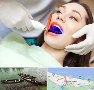 دندانپزشکی بدون درد در بندر انزلی