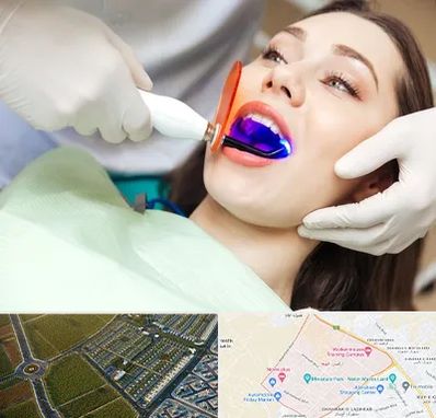 دندانپزشکی بدون درد در الهیه مشهد