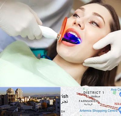 دندانپزشکی بدون درد در فرمانیه 